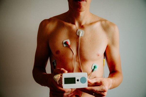 Holter EKG w klinice U Lekarzy - co warto wiedzieć o badaniu?