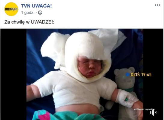Reportaż TVN UWAGA! o poparzonym Antosiu