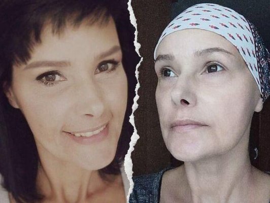 Mieszkanka Grójca walczy o swoje życie. Wesprzyj i dołóż swoją cegiełkę 