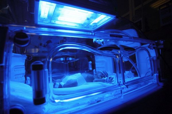 Niepełnosprawne dziecko przez błąd lekarza